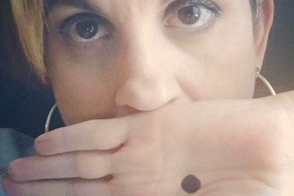 Черная точка на ладони: почему ни под каким предлогом нельзя игнорировать этот знак!