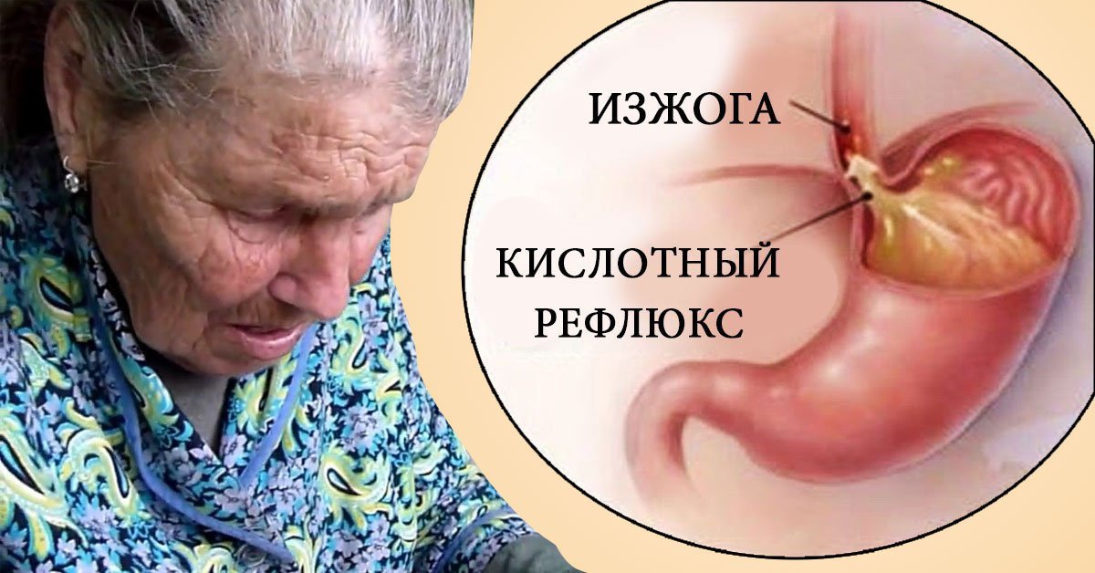 Продукты, вызывающие изжогу