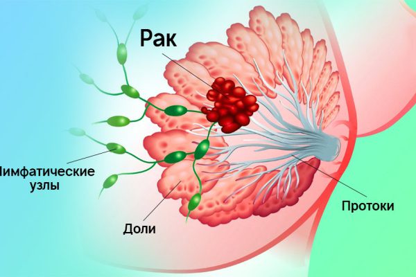 Анджелина Джоли — худший из примеров! Вот кому на самом деле стоит провериться у генетика…