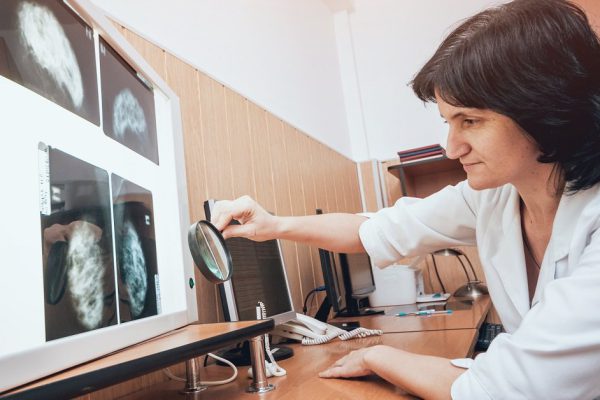 Doctor examine mammography test. Medical equipment at the hospital. Background