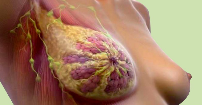 рак молочных желез фото