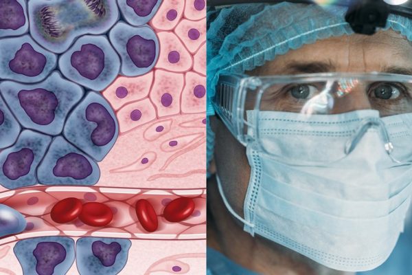 Ранняя диагностика рака