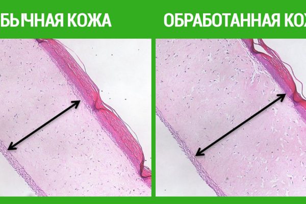 Крем с добавлением чудодейственного антиоксиданта спасет от старения! Все в аптеку…