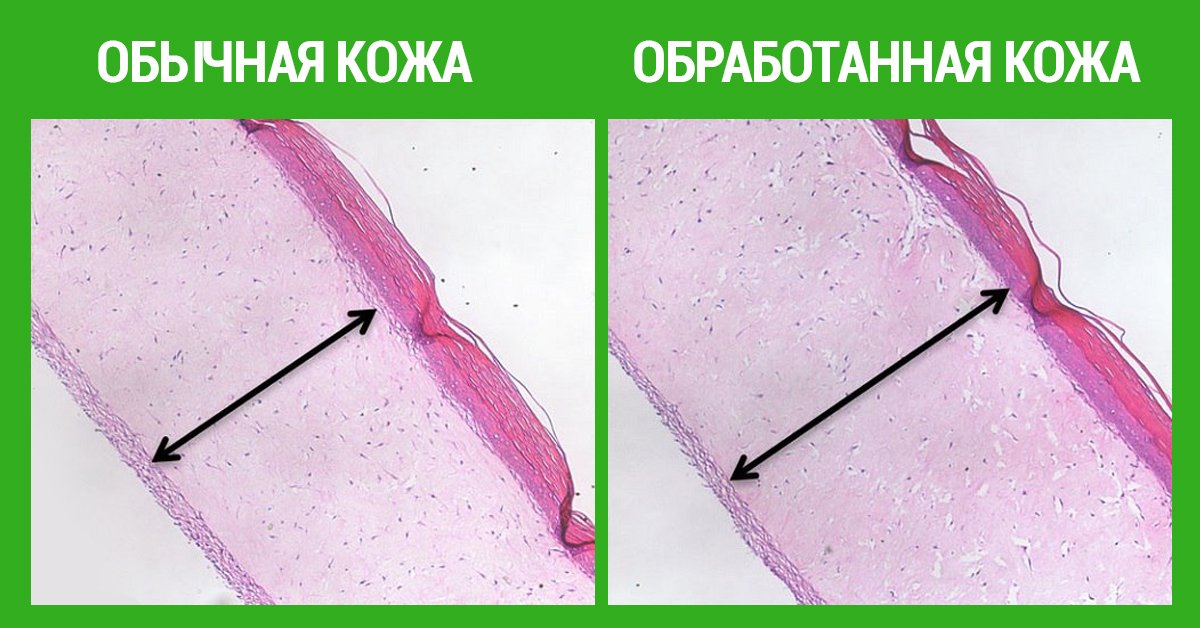 Метиленовый Синий Статья