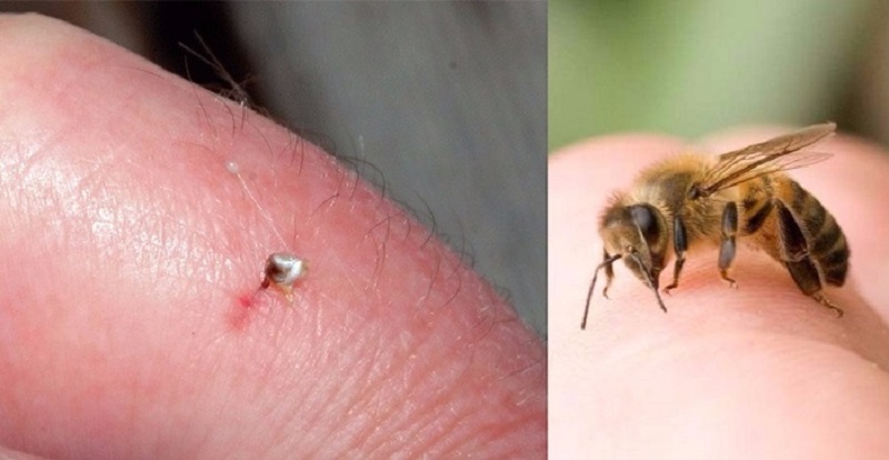 как выглядит пчелиный укус