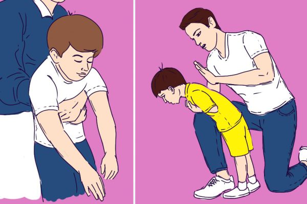 Что делать, если ребенок подавился и задыхается