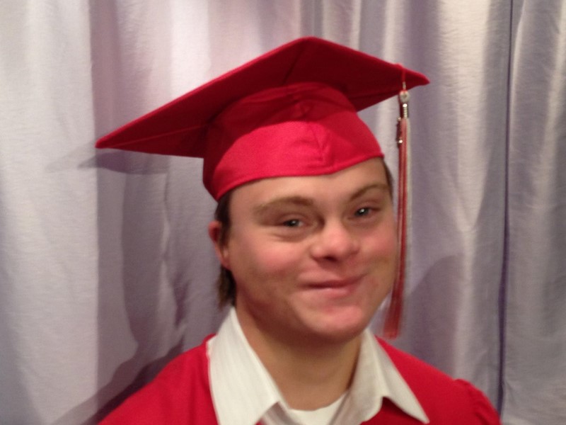 красивые дети с синдромом дауна