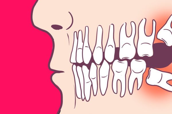 Вот оно, доказательство теории Дарвина! 6 органов, которые тебе больше не нужны.