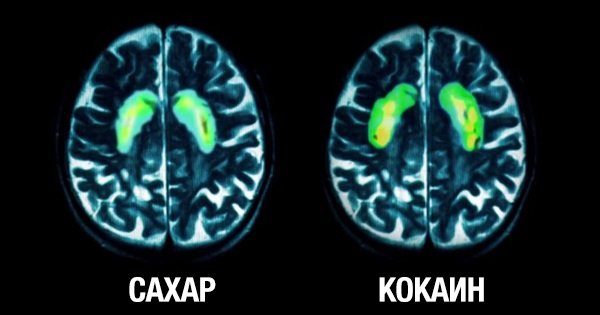 Вот как действует обычный сахар на твой мозг. Жаль, что я не прочитал этого раньше…