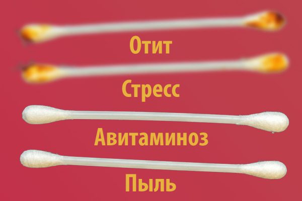 Отоларинголог: «Цвет ушной серы расскажет всё о состоянии здоровья!»