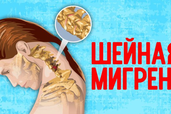 Сегодня шея болит особенно сильно: кажется, полез бы под гильотину