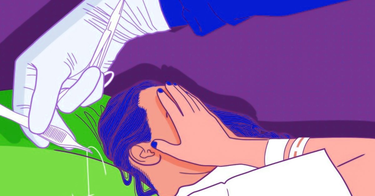 Швы после эпизиотомии