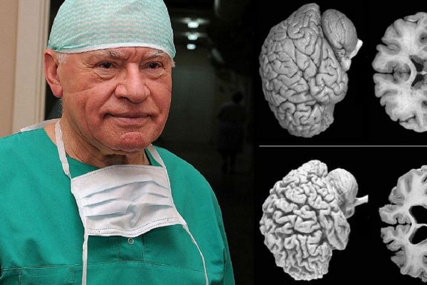 Неврологи бьют тревогу! Всем женщинам нужно прислушаться к этому совету…