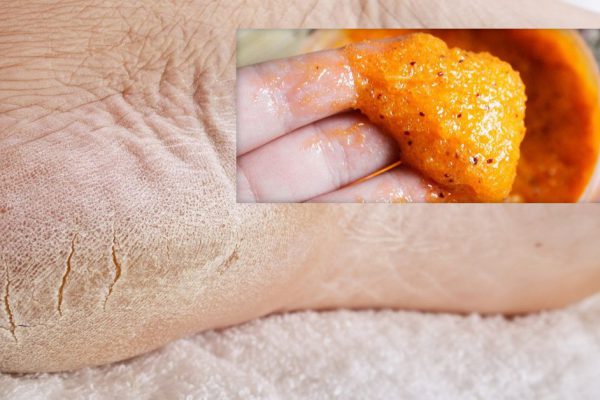 Раз в неделю делаю массаж стоп с этим средством. Никакой отечности, сухости и трещин. Советую!