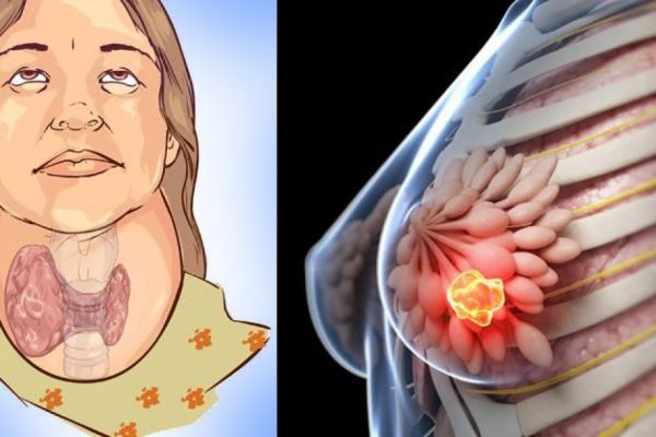 Всегда думала, что это полезный напиток. Оказалось, что он разрушает щитовидную железу! А еще…