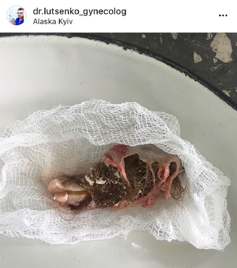 уникальные медицинские случаи