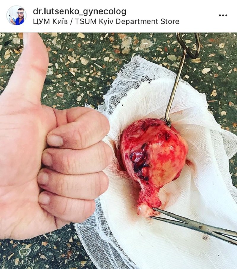 шокирующие медицинские случаи