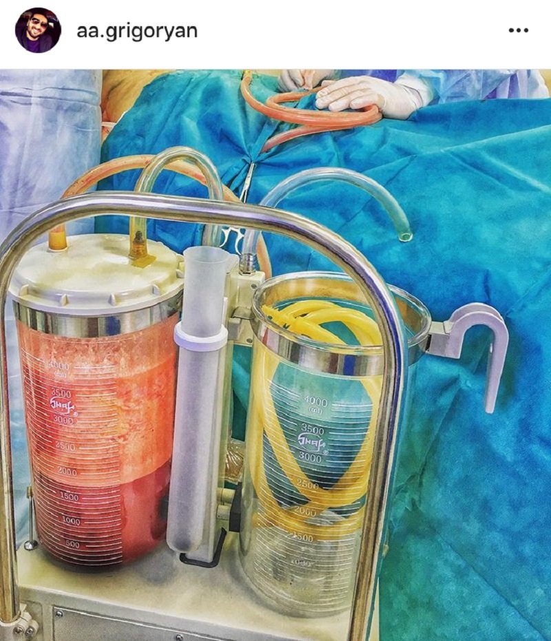 сложные медицинские случаи