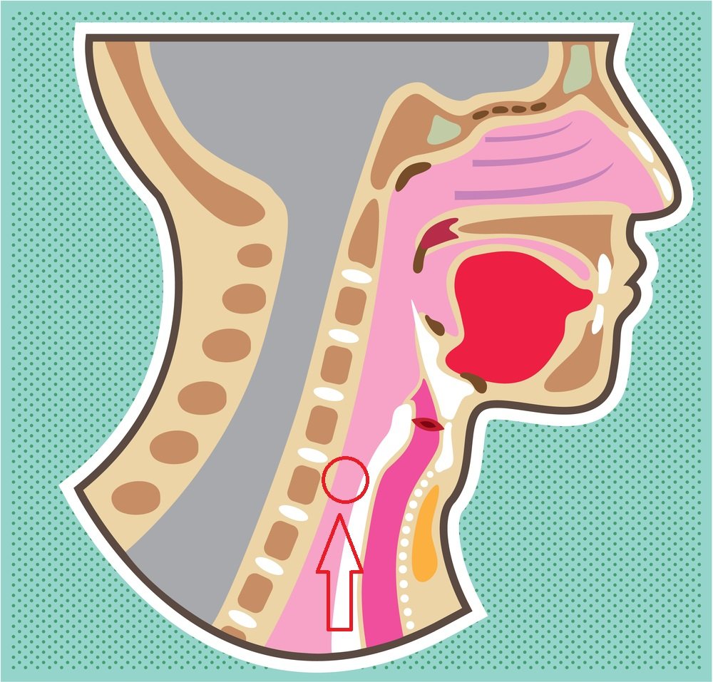 что делать если подавился едой
