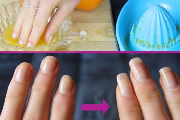 Всего 3 ингредиента помогут быстро отрастить крепкие и длинные ногти!