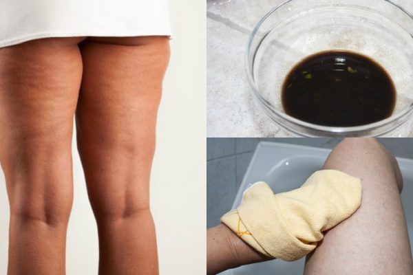 Горячее антицеллюлитное растирание: единственное средство, которое действительно работает!