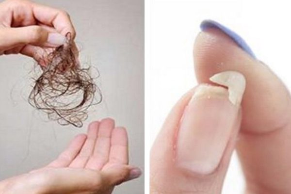 Если тебя беспокоит выпадение волос, ломкость ногтей или плохой сон, вот что нужно есть!