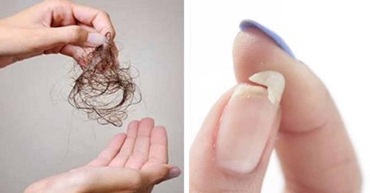 Чего не хватает в организме если выпадают волосы и ломаются ногти