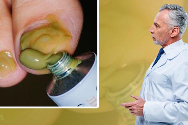 «Как с цепи сорвались! Сколько можно твердить, грибок бешено боится и высыхает до самого корня…»