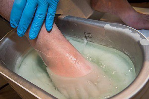 Грибок отсохнет с корнем! Возьми да намажь ноги обыкновенной…