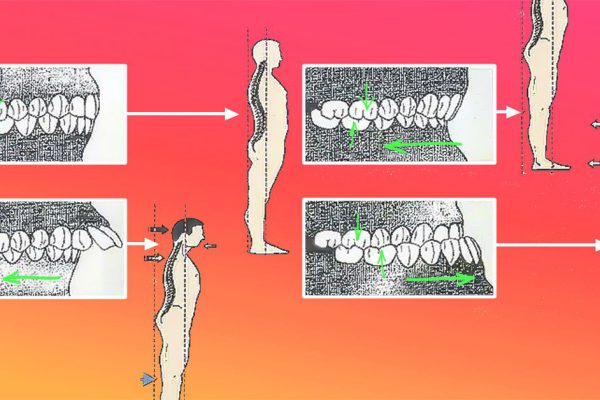 Челюсть и позвоночник неразрывно связаны: если болит спина, нужно лечить зубы!