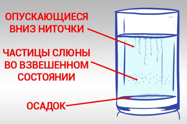 Моментальный тест на молочницу: невероятная точность до 90 % !