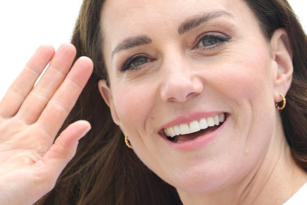 Старость не щадит даже Кейт Миддлтон, разбираемся в типах старения