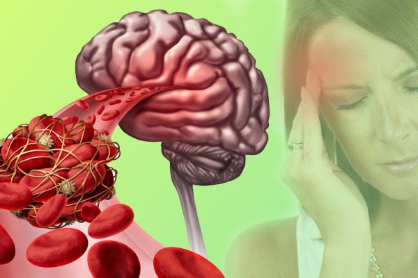 Безмолвные убийцы! Тромбы появляются и тихо убивают, потому что…