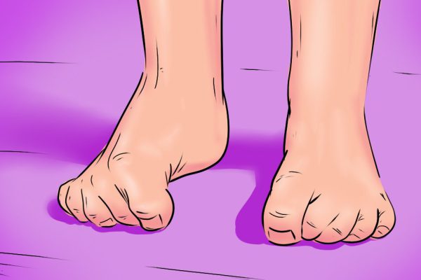 «Мама, ножки болят!» Как распознать и устранить ночные боли у детей