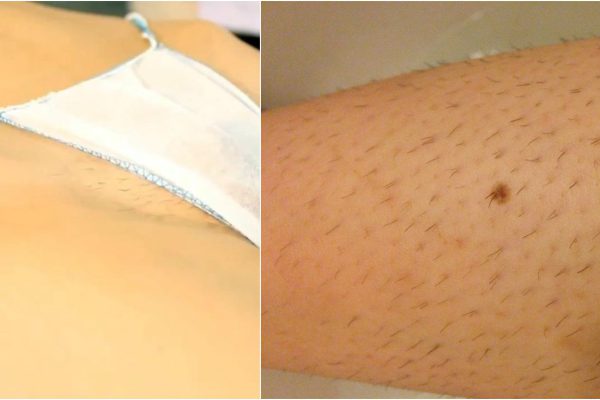 Не будь колючкой — приготовь ЭТО средство и подари коже гладкость надолго! Довольна результатом.