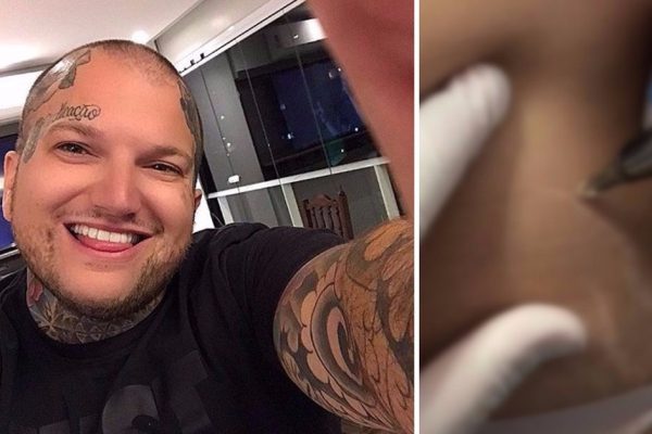 Этот парень с неординарной внешностью заставляет красавиц со всего мира лететь в Бразилию. Оказалось, он спасает от извечной женской…