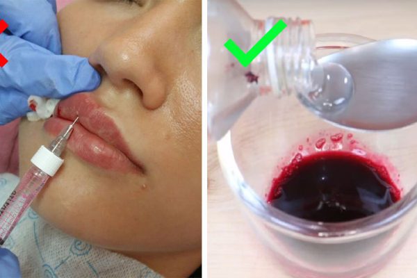 Мама боялась, что я начала колоть гиалуронку… Супертрюк для идеально гладких и чувственных губ!