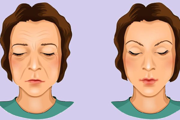 Продукты, которые негативно влияют на состояние кожи