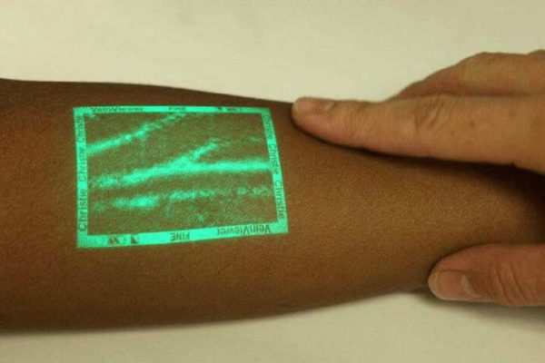 Изобретение будущего: уникальный аппарат поможет найти скрытую вену! Больше никаких мучений.