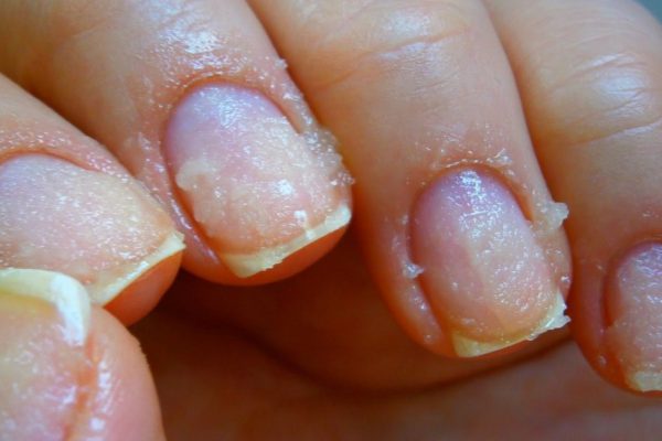 4 штучки для пострадавших ноготков! Восстанавливаемся после гель-лака.