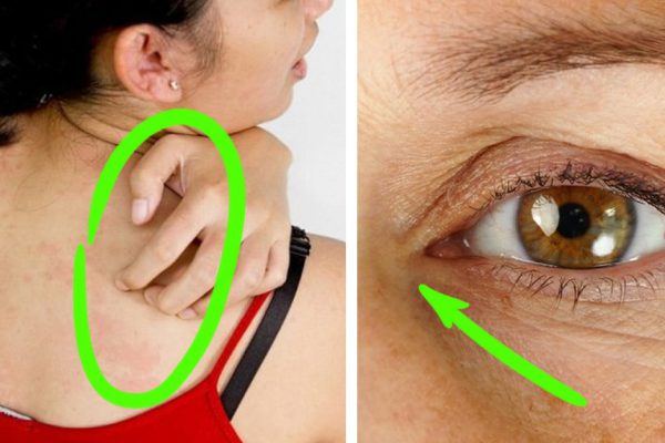 7 признаков того, что ты употребляешь слишком много сахара. Организм посылает сигналы.