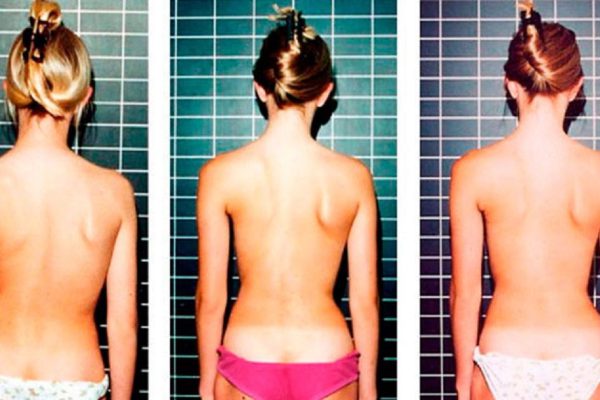 6 упражнений, которые эффективно исправляют осанку. В обязательном порядке попробую!