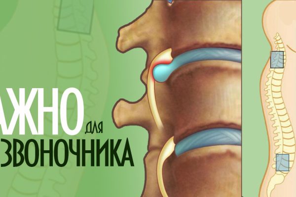 Узкий специалист: «Лечение межпозвоночной грыжи без лекарств, без операции! Нужно лишь упорно…»