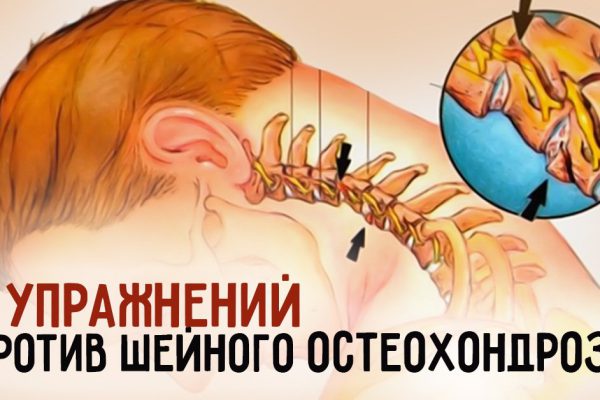 8 потрясающих упражнений от шейного остеохондроза. Сделай шаг к здоровью!