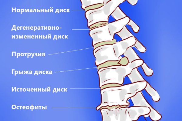 Боль усилилась и стала возникать всё чаще? Встань на четвереньки, руки расставь широко…