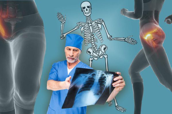 Хирурги, с уважением: «Защемление седалищного нерва не требует медикаментов! Успокоить воспаление помогут 2 простых…»