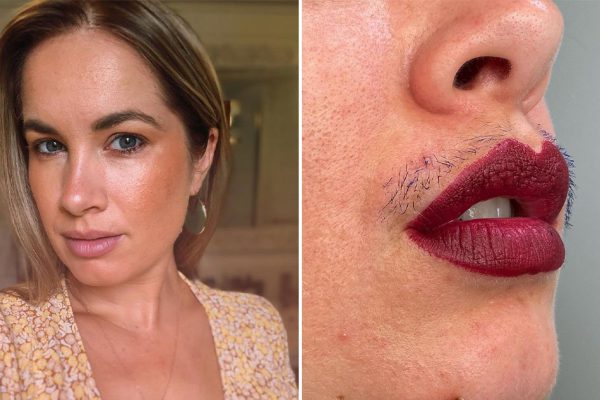 Почему всё больше блогеров отказываются использовать фильтры и выставляют напоказ свои особенности