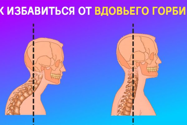 Как избавиться? «Отложение жира в области седьмого (7) шейного позвонка искореняется полностью, если…»