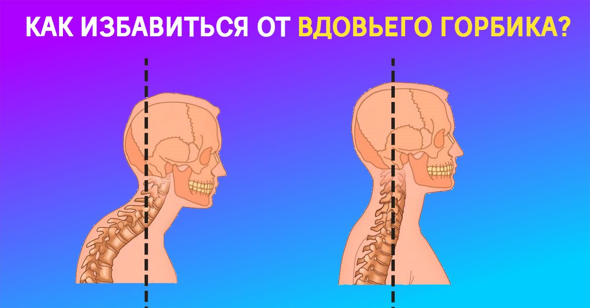 Вдовий горбик картинки