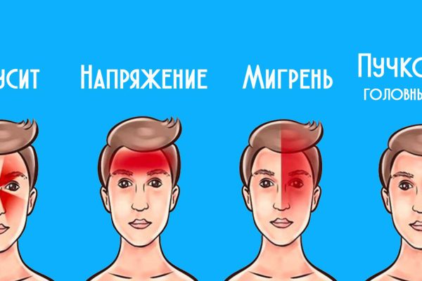 Рекомендация кардиохирурга: «Головную боль нельзя терпеть! Нельзя игнорировать! Боль в височной области указывает на неминуемый…»